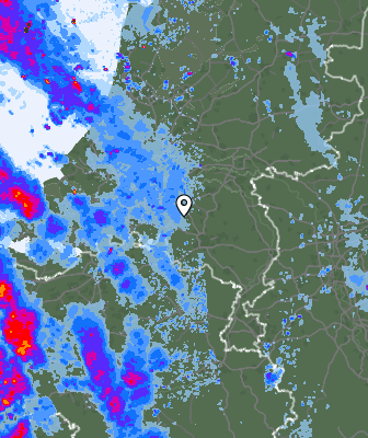 Radar