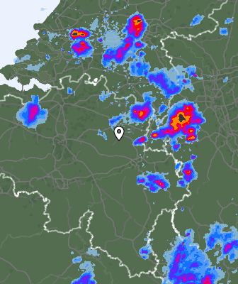 Radar