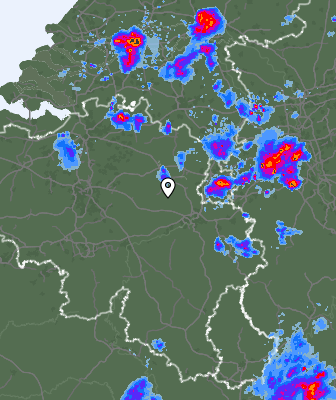 Radar