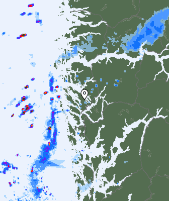 Radar