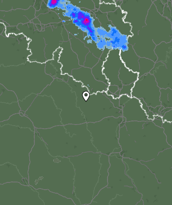 Radar