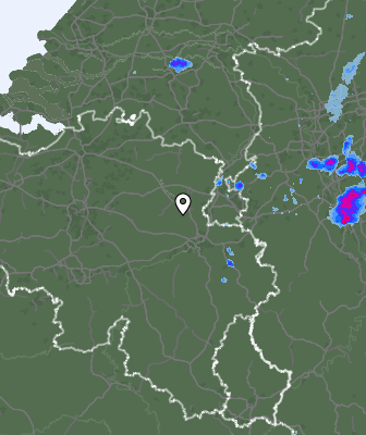 Radar