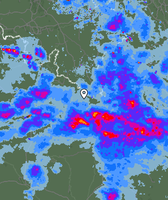 Radar