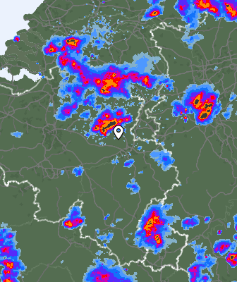 Radar