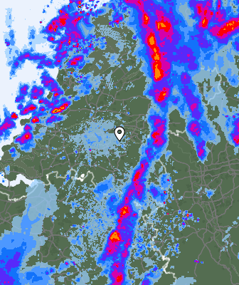 Radar