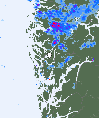 Radar