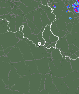 Radar