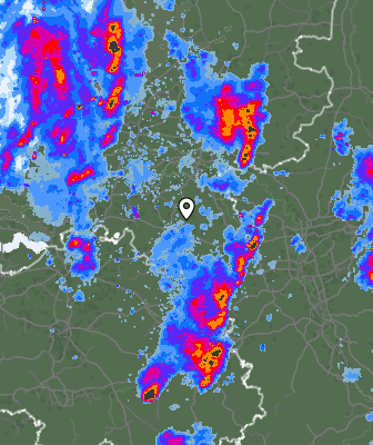 Radar