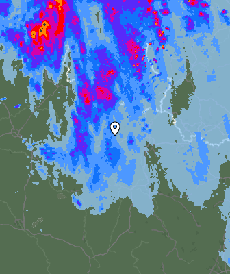Radar