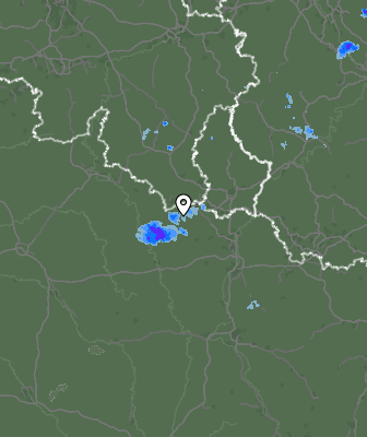 Radar