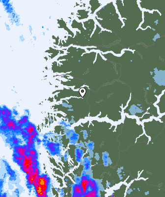 Radar