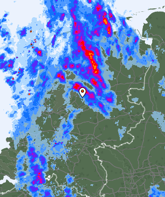 Radar