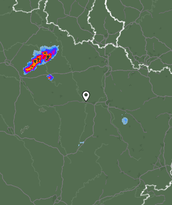 Radar