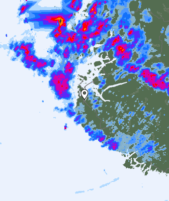Radar