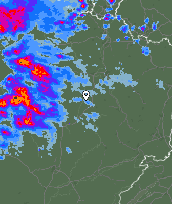 Radar