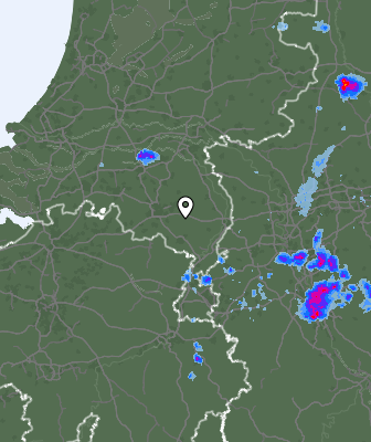 Radar