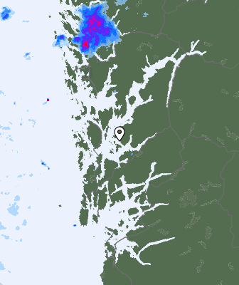 Radar