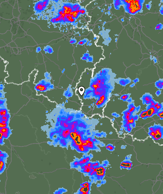 Radar