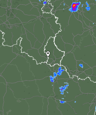 Radar