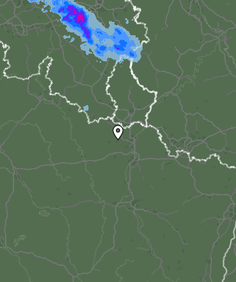 Radar