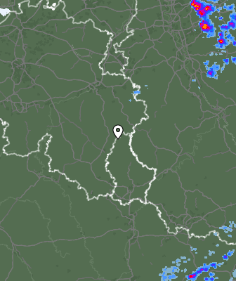 Radar