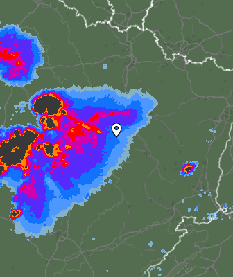Radar