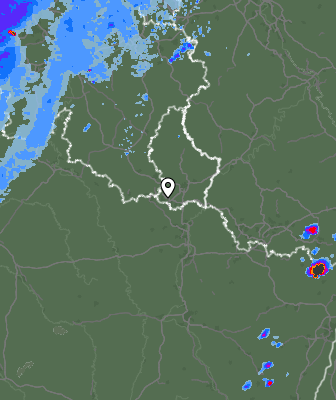 Radar