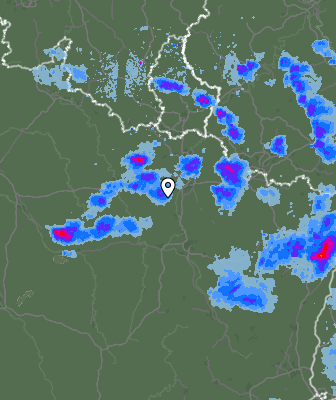 Radar