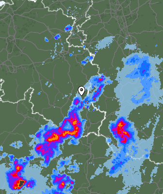 Radar