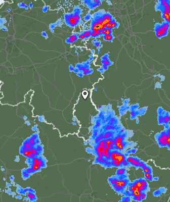 Radar