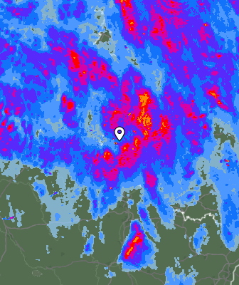 Radar