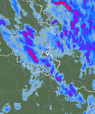 Radar
