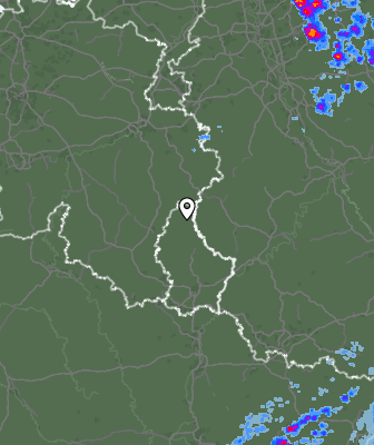 Radar