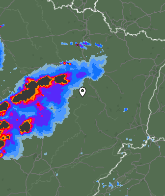 Radar