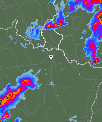 Radar