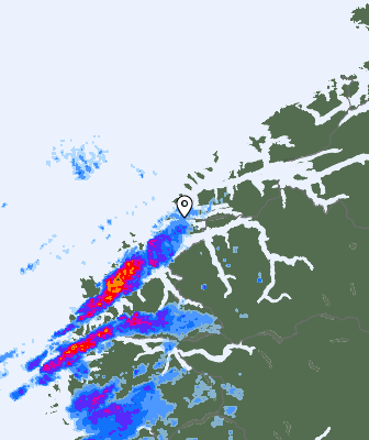 Radar