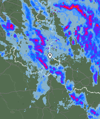 Radar