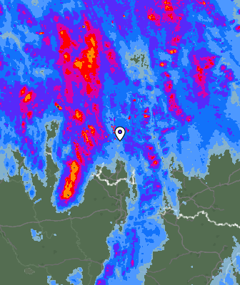 Radar