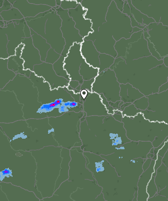 Radar
