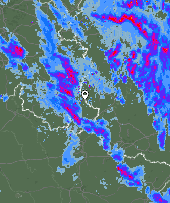 Radar