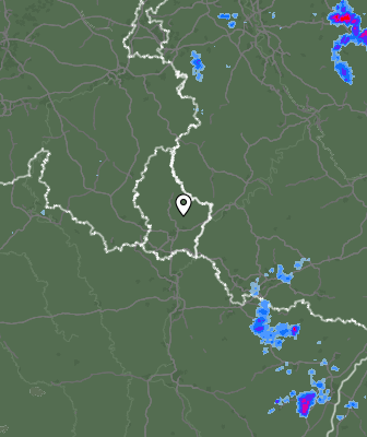 Radar