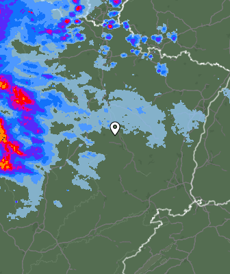 Radar
