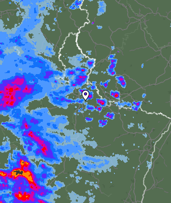 Radar