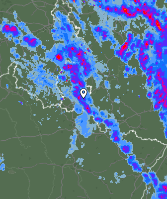 Radar
