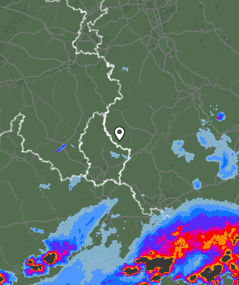 Radar