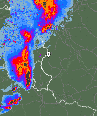Radar