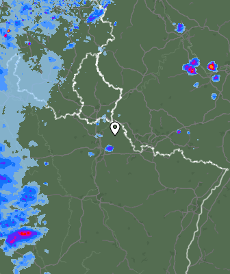 Radar