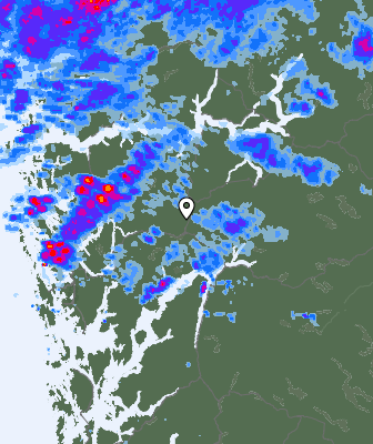 Radar