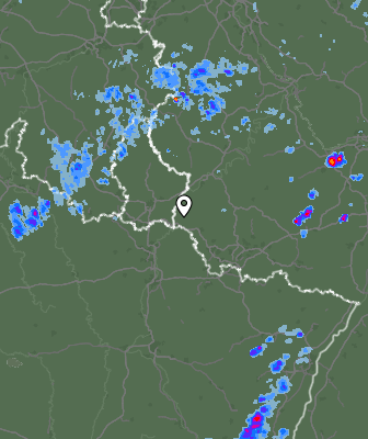 Radar