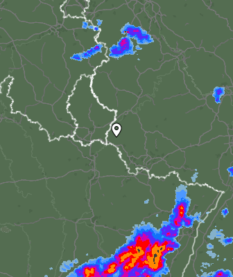 Radar